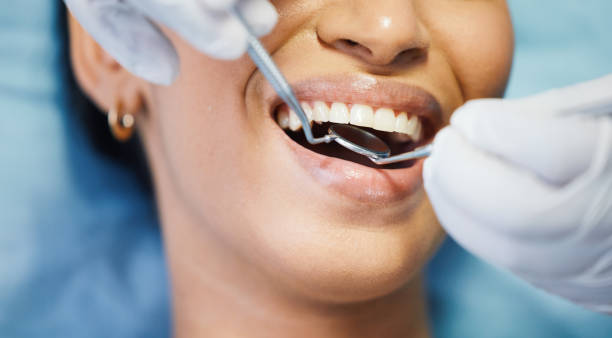 Best Emergency Broken Tooth Repair in Hot Springs, SD